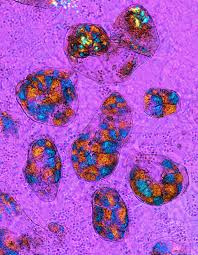 Attēlu rezultāti vaicājumam “Lycogala succineum”