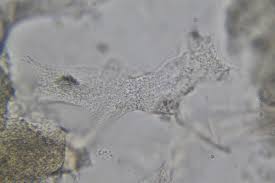 Attēlu rezultāti vaicājumam “Badhamia flavoglauca spores”