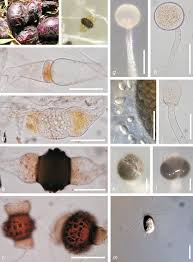 Attēlu rezultāti vaicājumam “Gulielmina vermicularis spores”