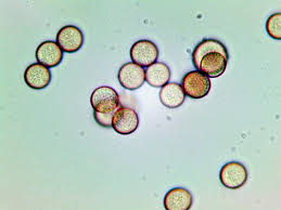 Attēlu rezultāti vaicājumam “Stemonitopsis subcaespitosa”
