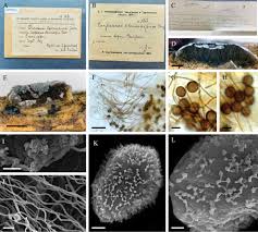 Attēlu rezultāti vaicājumam “Perichaena corticalis spores”
