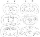 Distribution and differences of estrogen receptor beta ... 
