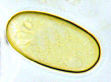 Attēlu rezultāti vaicājumam “Lycogala botrydium spores”