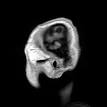 Acquired brain injury - Wikipedia, the free encyclopedia