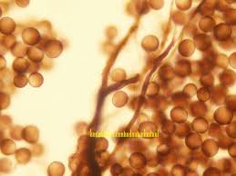 Attēlu rezultāti vaicājumam “Amaurochaete atra spores”