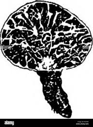 Attēlu rezultāti vaicājumam “Trichia varia sessile”