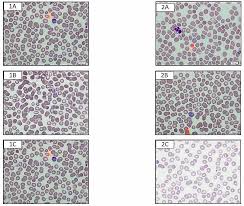 Attēlu rezultāti vaicājumam “Siphoptychium violaceum plasmodium”