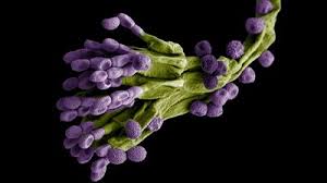 Attēlu rezultāti vaicājumam “Mycosphaerella ulmi”