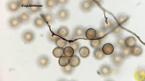 Attēlu rezultāti vaicājumam “Comatricha ellae spores”