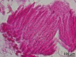 Attēlu rezultāti vaicājumam “Neonectria fuckeliana”