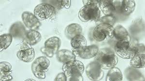 Attēlu rezultāti vaicājumam “Tranzschelia pruni-spinosae spores”