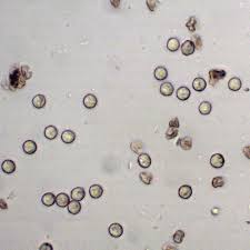 Attēlu rezultāti vaicājumam “Arcyria incarnata”