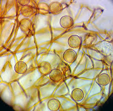 Attēlu rezultāti vaicājumam “Lycogala ustulatum macro”