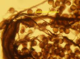 Attēlu rezultāti vaicājumam “Amaurochaete atra macro”