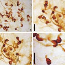 Attēlu rezultāti vaicājumam “Bactridium flavum”