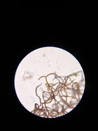 Attēlu rezultāti vaicājumam “Lycogala irregulare macro”