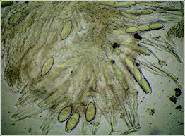 Attēlu rezultāti vaicājumam “Pertusaria leioplaca”