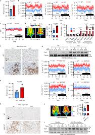 Image result for BCKA