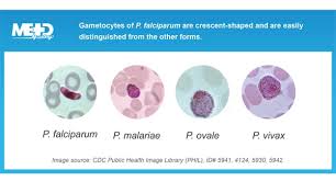 Attēlu rezultāti vaicājumam “Reticularia lobata plasmodium”