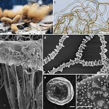 Attēlu rezultāti vaicājumam “Lycogala conicum spores”