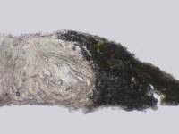 Attēlu rezultāti vaicājumam “Pertusaria flavida”