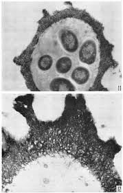 Attēlu rezultāti vaicājumam “Arcyria cinerea young”