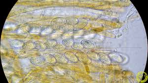 Attēlu rezultāti vaicājumam “Miladina lecithina”