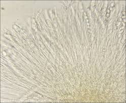 Attēlu rezultāti vaicājumam “Myriosclerotinia scirpicola”