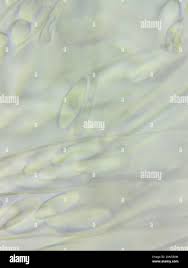 Attēlu rezultāti vaicājumam “Cudoniella acicularis”