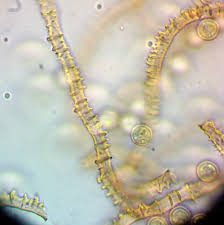 Attēlu rezultāti vaicājumam “Arcyria, Heterotrichia sp.”