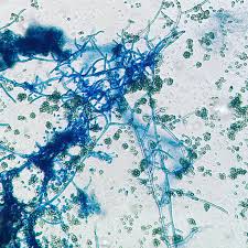 Attēlu rezultāti vaicājumam “Dianema depressum spores”