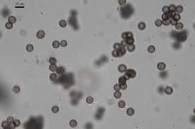 Attēlu rezultāti vaicājumam “Physarum rubiginosum plasmodium”