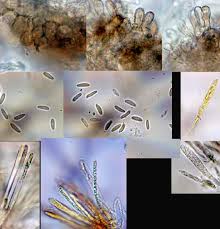 Attēlu rezultāti vaicājumam “Mollisia amenticola”