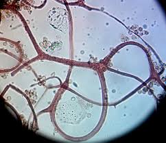 Attēlu rezultāti vaicājumam “Lycogala sphaeroconicum sessile”