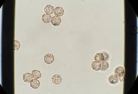 Attēlu rezultāti vaicājumam “Trichia botrytis spores”