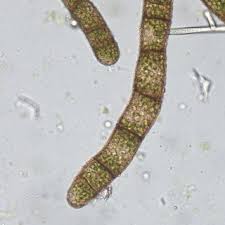 Attēlu rezultāti vaicājumam “Bryum neodamense macro”