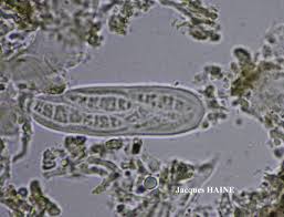Attēlu rezultāti vaicājumam “Alyxoria varia”