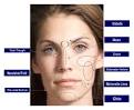 Fillers Treatment, India Low Cost Skin Fillers, India Injectable ...