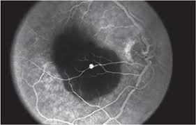 Attēlu rezultāti vaicājumam “Reticularia jurana macro”
