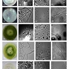 Attēlu rezultāti vaicājumam “Trichia longipalpis spores”