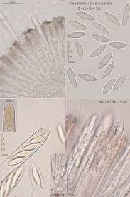 Attēlu rezultāti vaicājumam “Cudoniella acicularis”