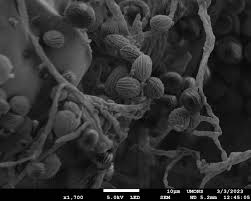 Attēlu rezultāti vaicājumam “Physarum xanthinum spores”