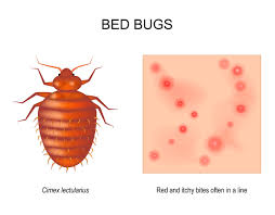 Image result for bed bug bites