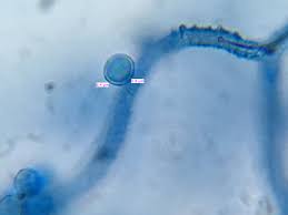 Attēlu rezultāti vaicājumam “Arcyria helvetica”