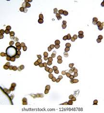 Attēlu rezultāti vaicājumam “Tranzschelia pruni-spinosae spores”