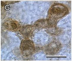 Attēlu rezultāti vaicājumam “Lycogala miserum macro”