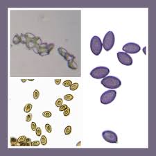 Attēlu rezultāti vaicājumam “Diachea subsessilis spores”