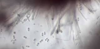 Attēlu rezultāti vaicājumam “Chlorencoelia versiformis”