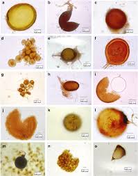 Attēlu rezultāti vaicājumam “Amaurochaete fusiformis spores”