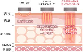 「エレア・サーブラフ」の画像検索結果
